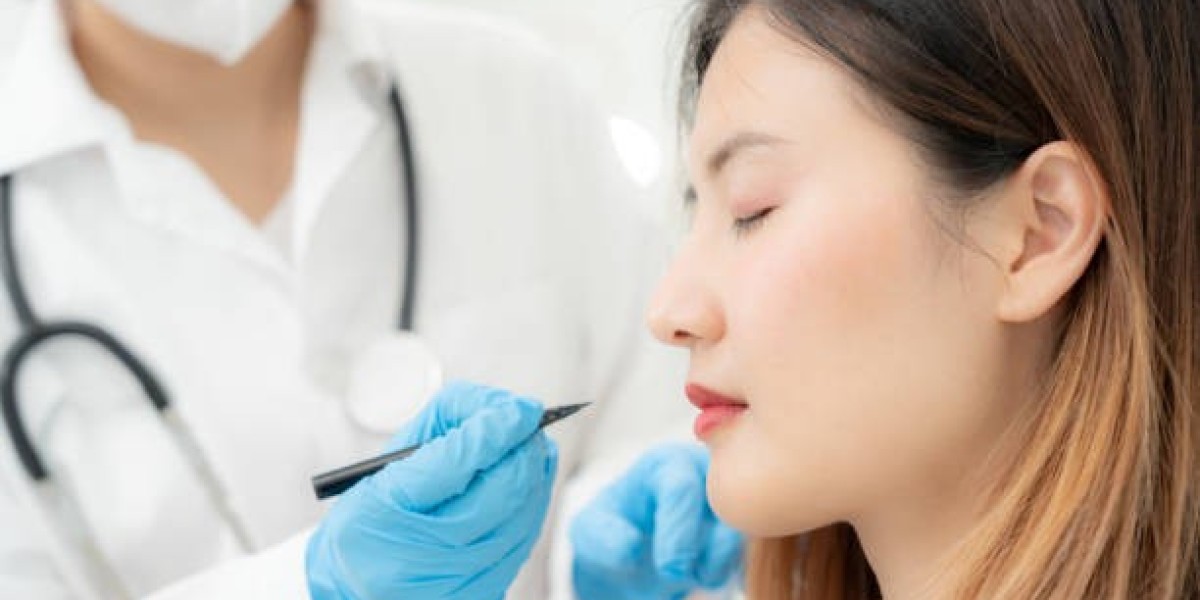 Is Rhinoplasty Right for You? Key Benefits and What to Expect
